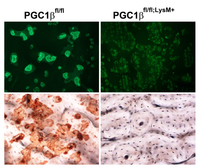 Project 3 PGC1 and osteoclast resized