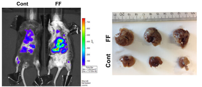 Project 4 tumor project resized