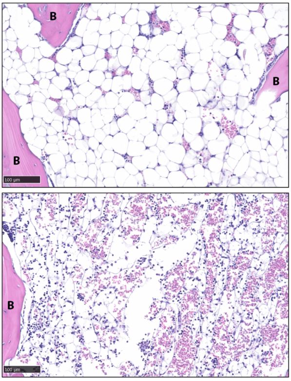 Specific brain signals rapidly eliminate body fat in mice